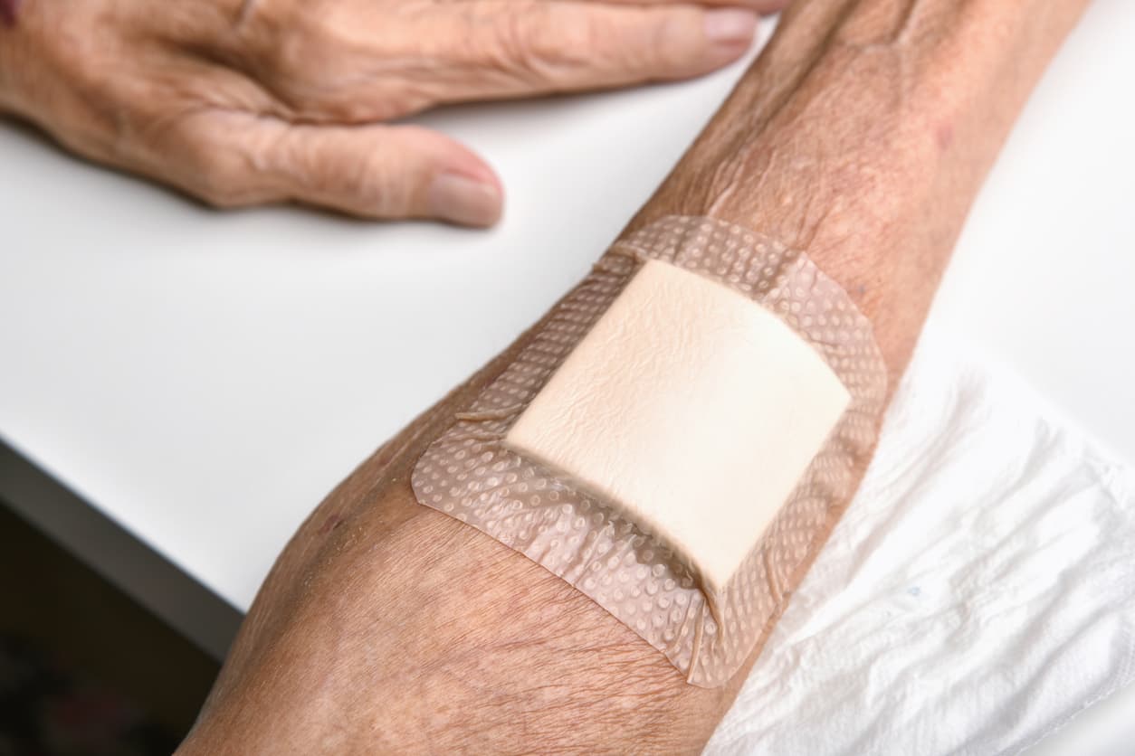 Nurse applying a wound dressing during home care